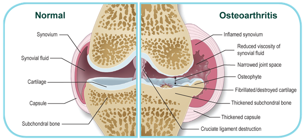 Osteoarthritis in Cats and Dogs - what is it? Osteoarthritis in Cats and Dogs - what is it?